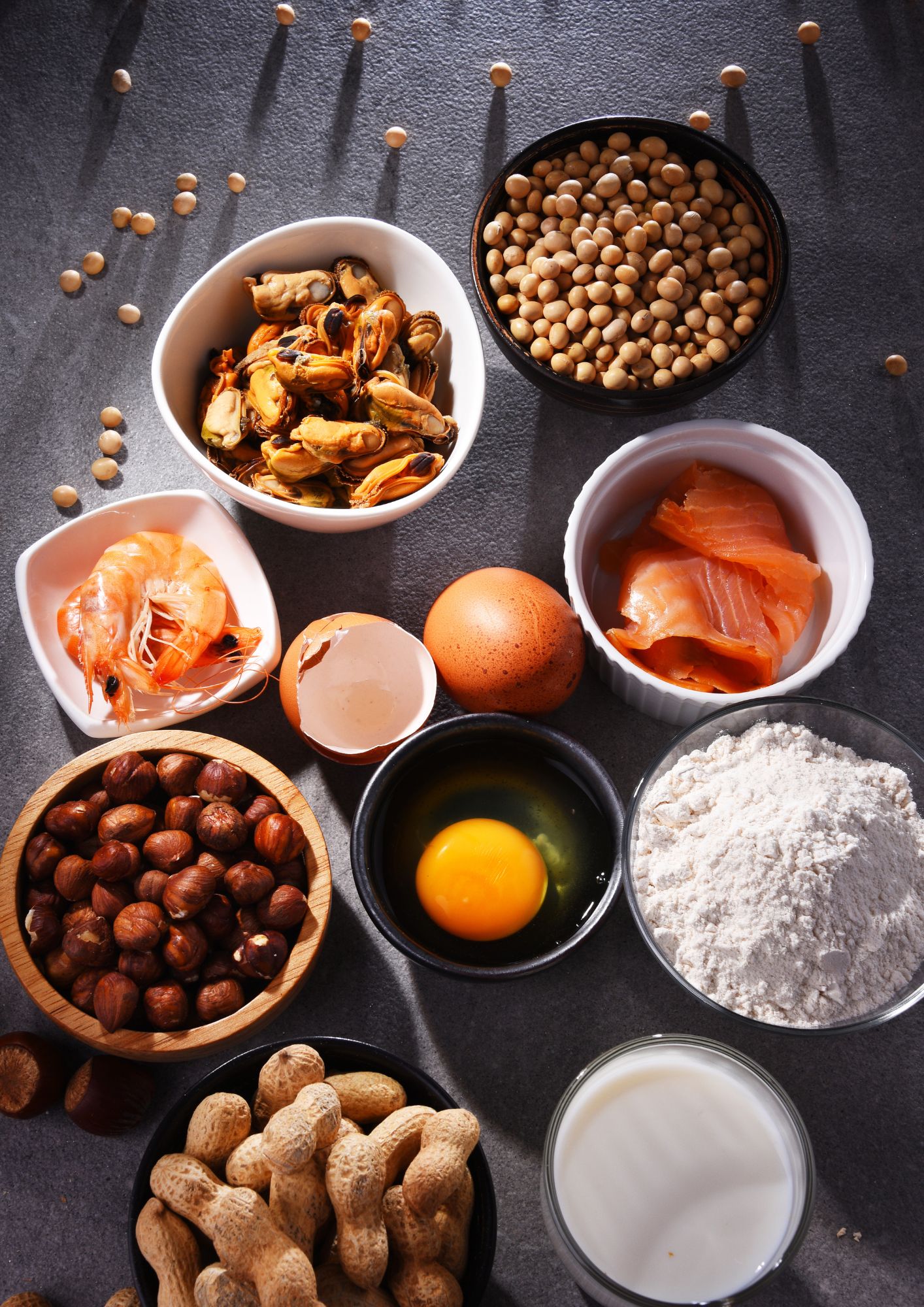 A picture of the top food allergens.