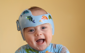A baby smiles whilst wearing a helmet used for treating flat head conditions in babies.